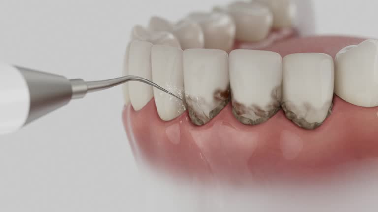 Reliable Emergency Dentist contractor in Cascade, ID by Smile Center Dentistry